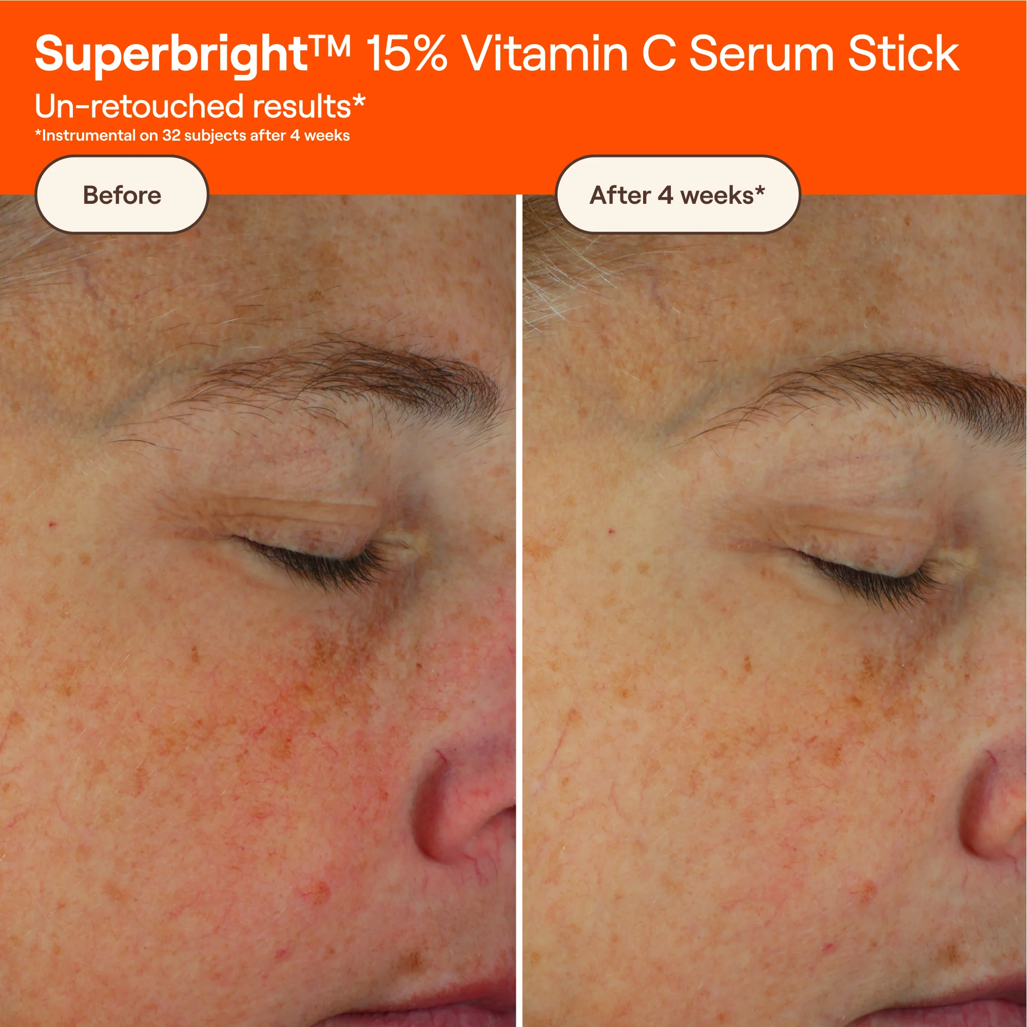 SUPERBRIGHT™ 15% Vitamin C Serum Stick - Image 3