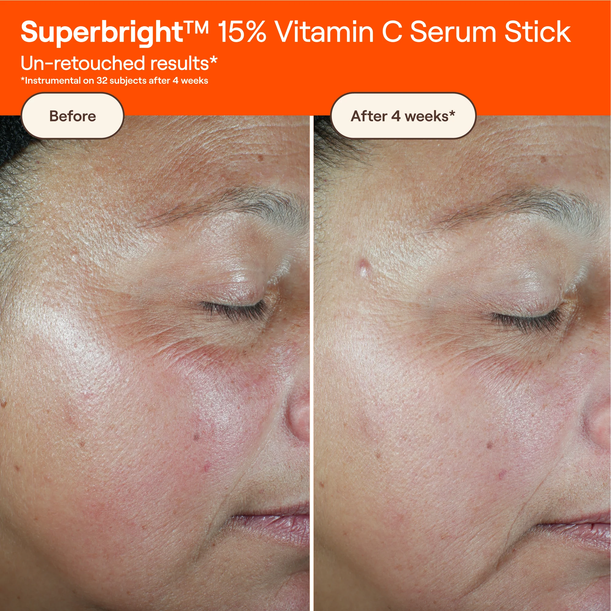 SUPERBRIGHT™ 15% Vitamin C Serum Stick - Image 4
