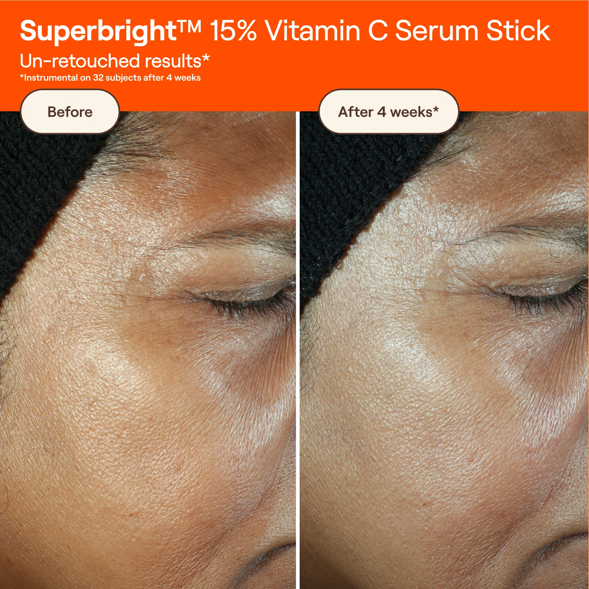 SUPERBRIGHT™ 15% Vitamin C Serum Stick - Image 5