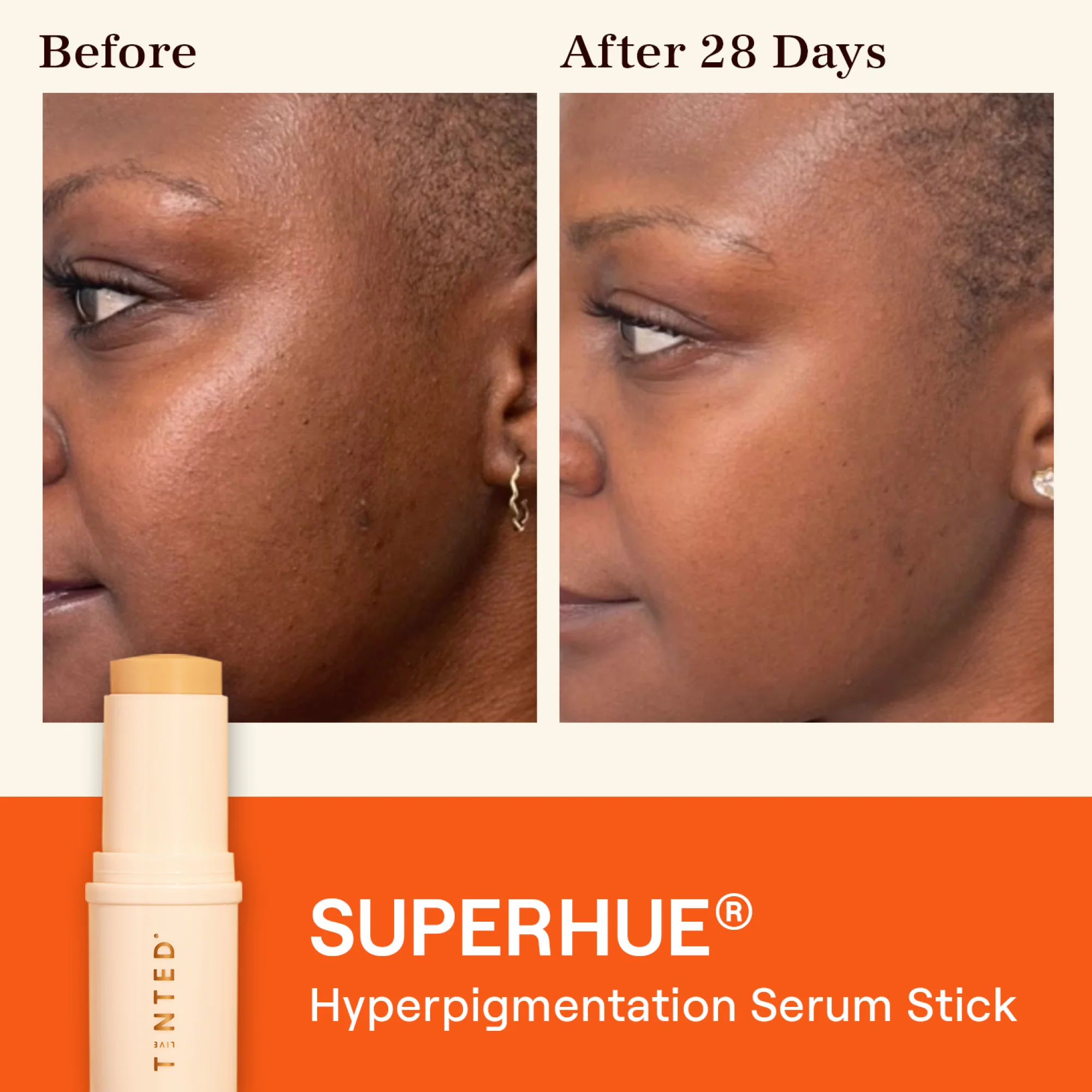 SUPERHUE® Hyperpigmentation Serum Stick - Image 3